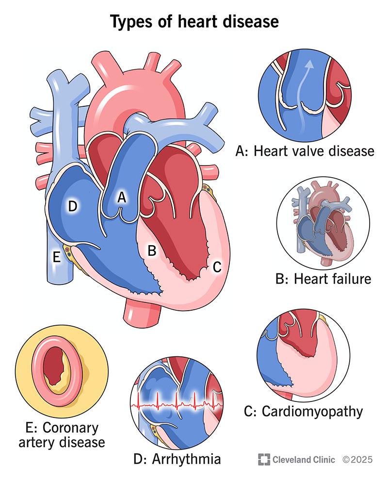 Heart Health