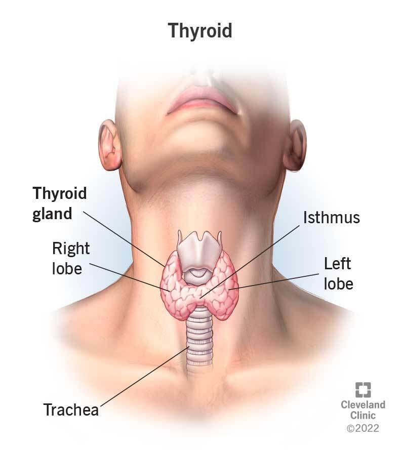 Hypothyroidism
